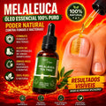 100% Pure Tea Tree Essential Oil with Dropper 30ML