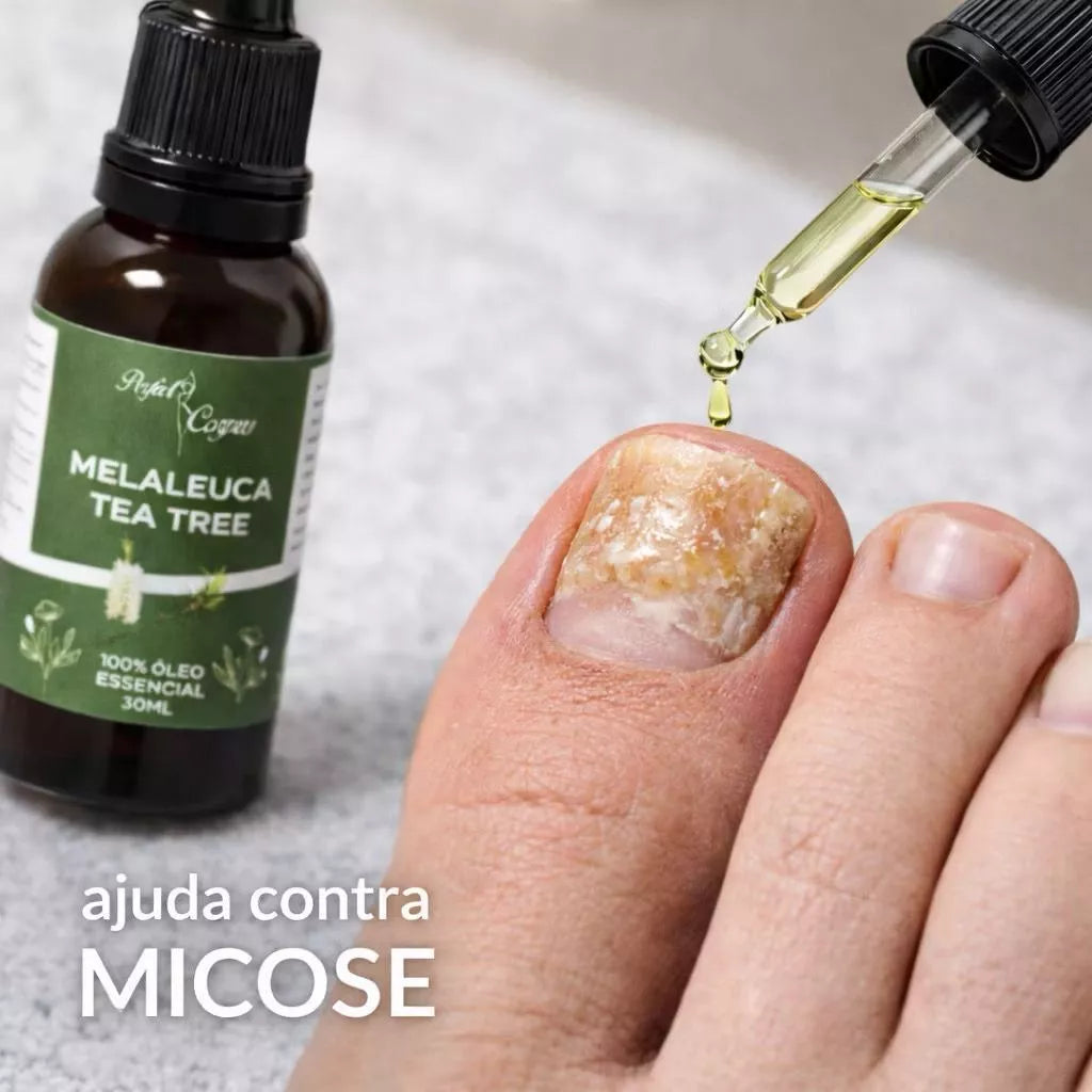 100% Pure Tea Tree Essential Oil with Dropper 30ML