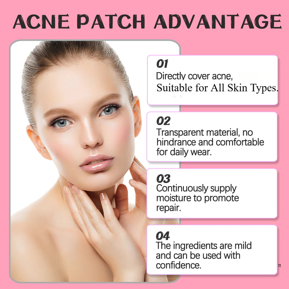 360 Pcs Acne Patches for Face, Hydrocolloid Pimple Cover Pimples and Spots, Spot Patch