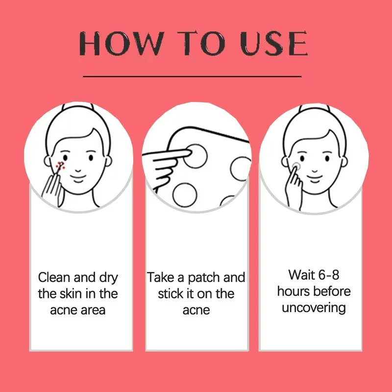 360 Pcs Acne Patches for Face, Hydrocolloid Pimple Cover Pimples and Spots, Spot Patch