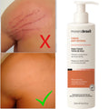Anti-Stretch Mark Cream - Say Goodbye to Stretch Marks! Prevents New Stretch Marks & Strengthens Skin Elasticity