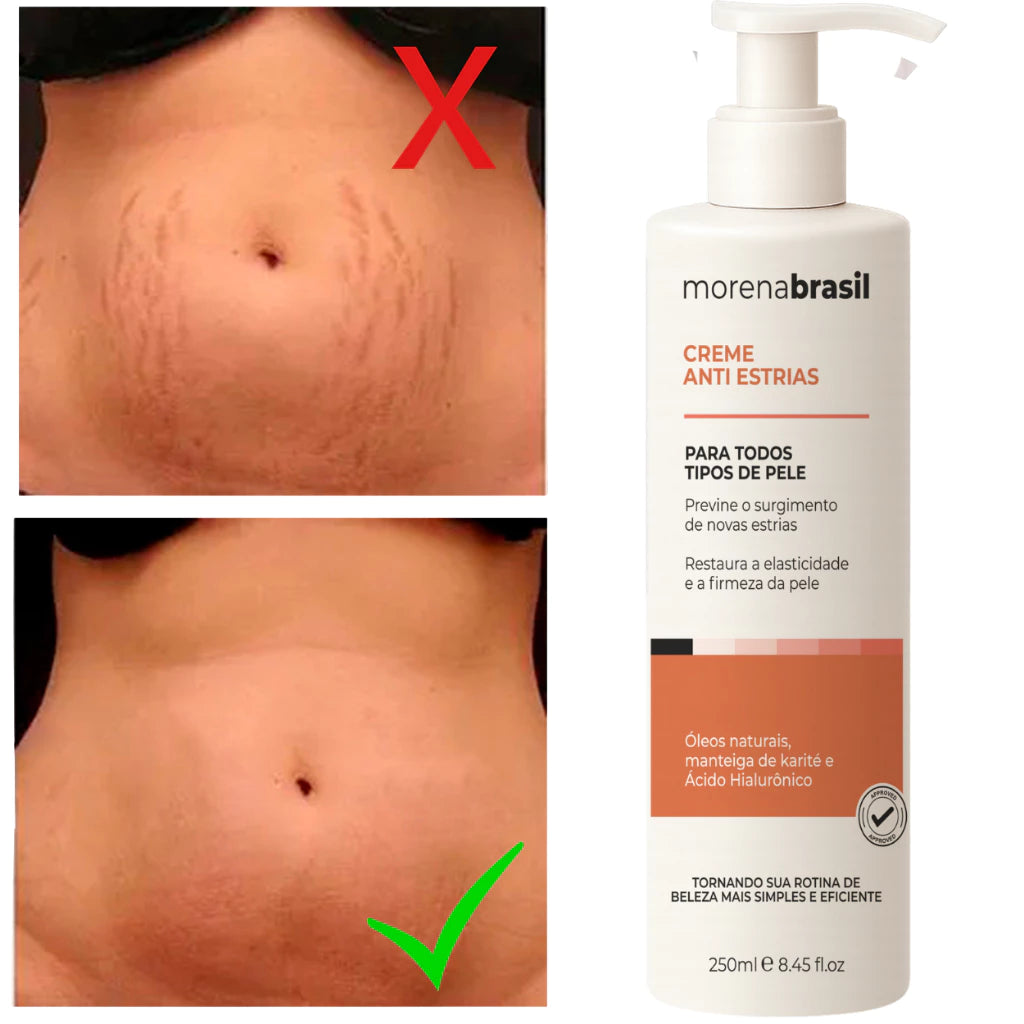 Anti-Stretch Mark Cream - Say Goodbye to Stretch Marks! Prevents New Stretch Marks & Strengthens Skin Elasticity