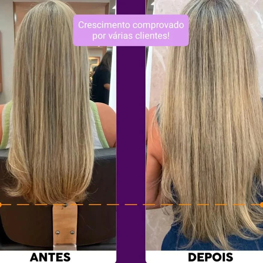 Biovin-A Horse Strength Complete Hair Growth Kit + LA Growth Tonic and Combing Cream