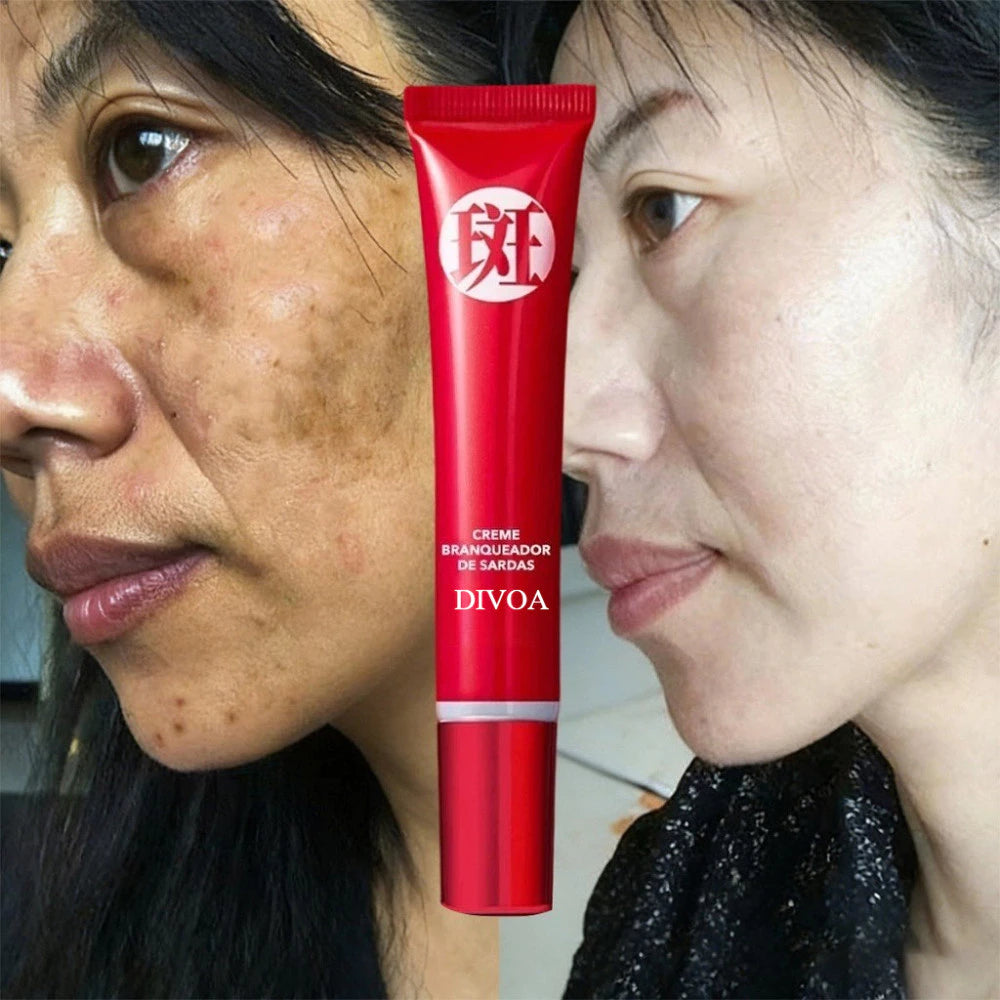 Creme para Manchas Escuras - Clareamento, Antipigmentação e Cuidados com a Pele