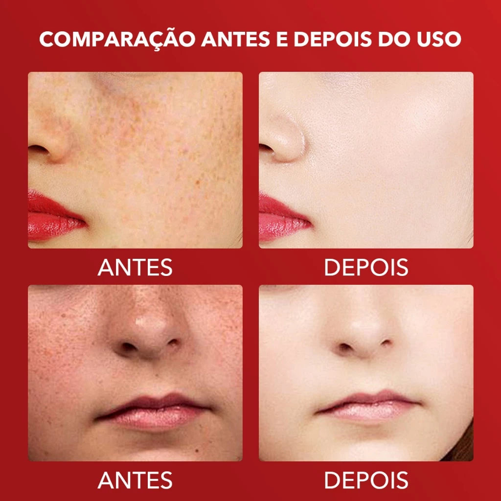 Creme para Manchas Escuras - Clareamento, Antipigmentação e Cuidados com a Pele