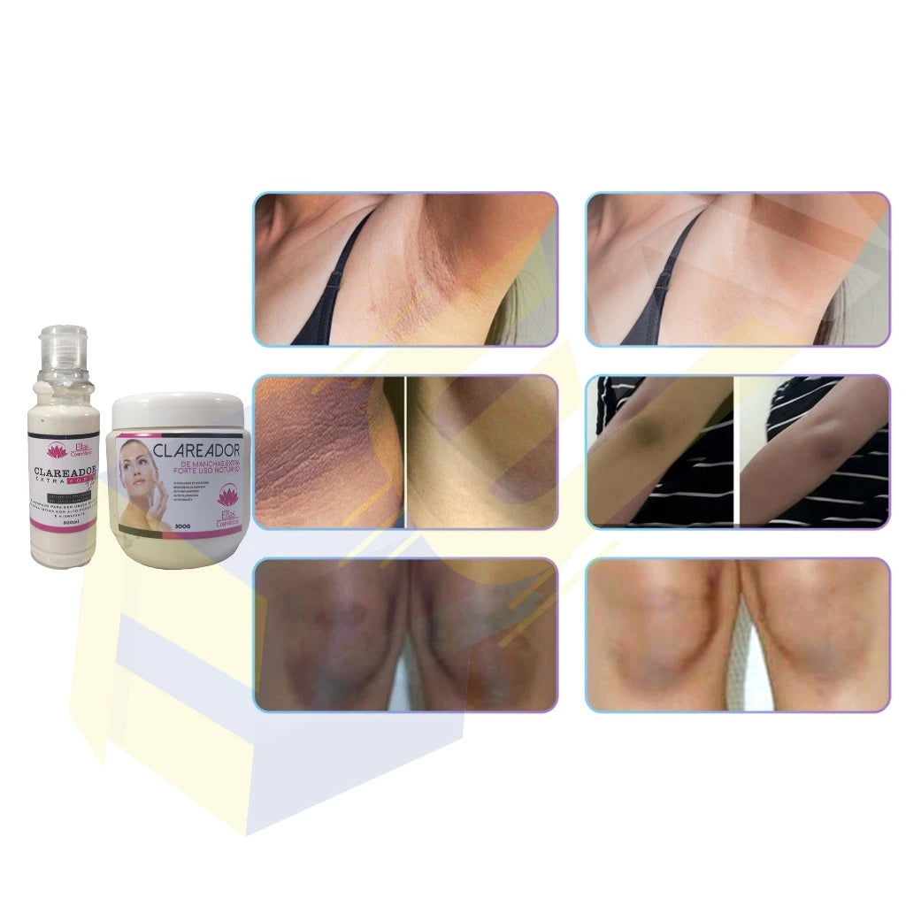 Extra Strong Intimate & Full Body Whitening Kit – Night Use