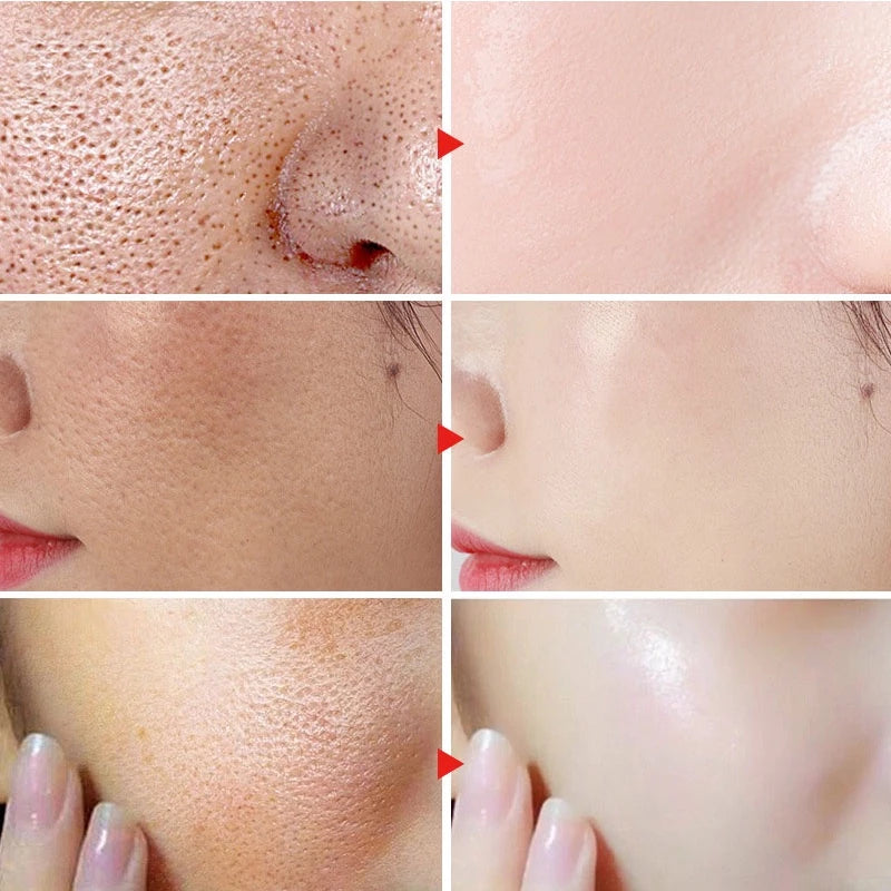 FDA Lactobionic Acid Hyaluronic Serum Moisturizing Smooth Pores Firm Repair Essence