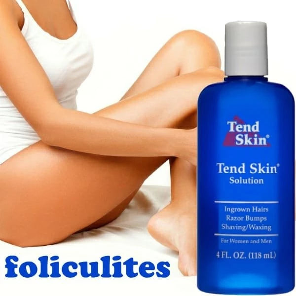Folliculitis and Ingrown Hair Lotion 118ml
