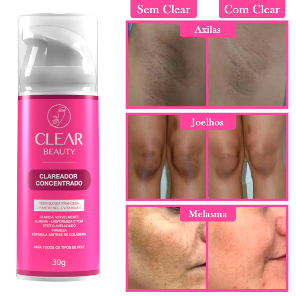 Groin and Armpit Whitening Cream for Intimate Parts - Clear Beauty