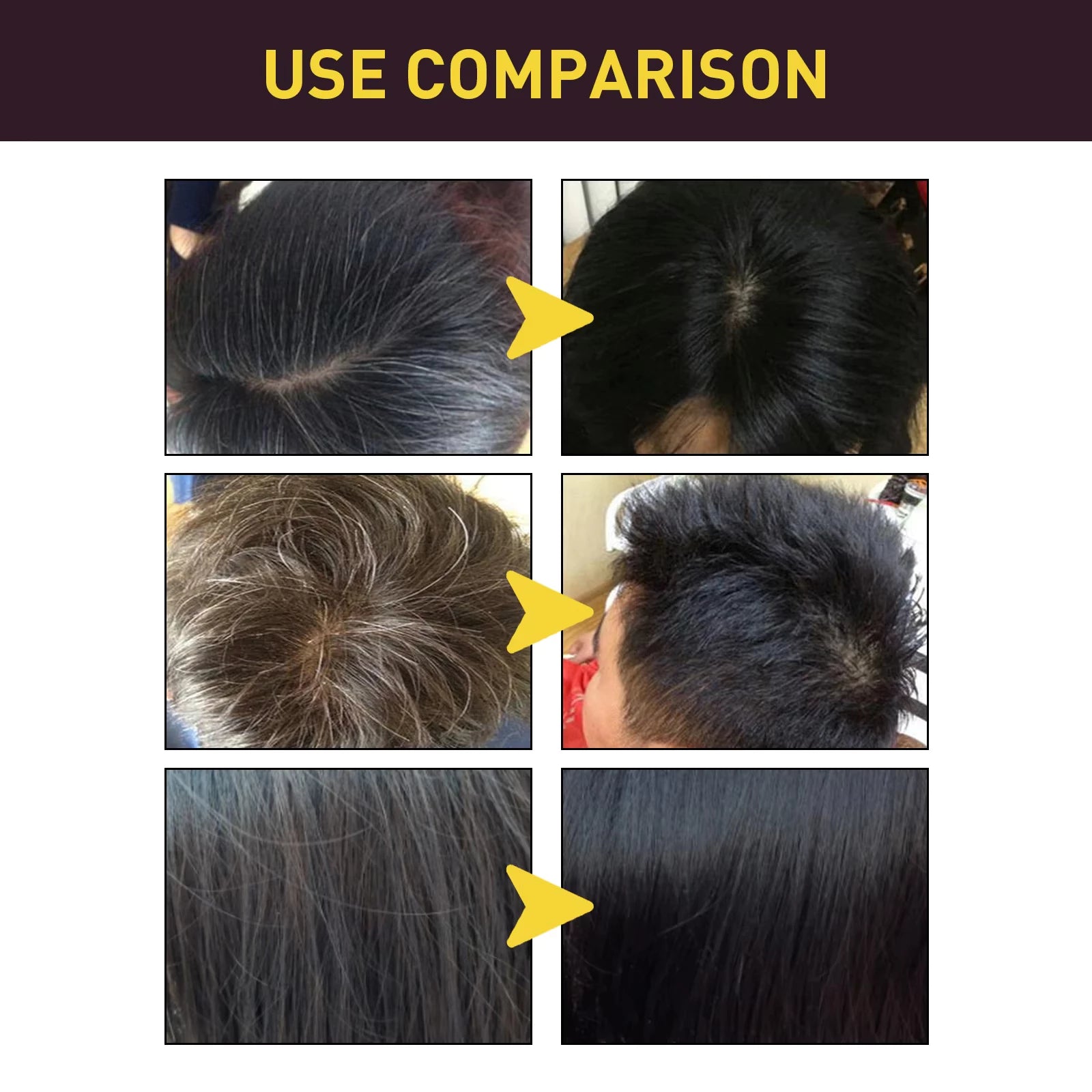 He Shou Wu Hair Shampoo – Moisturizes, Repairs & Naturally Darkens Hair