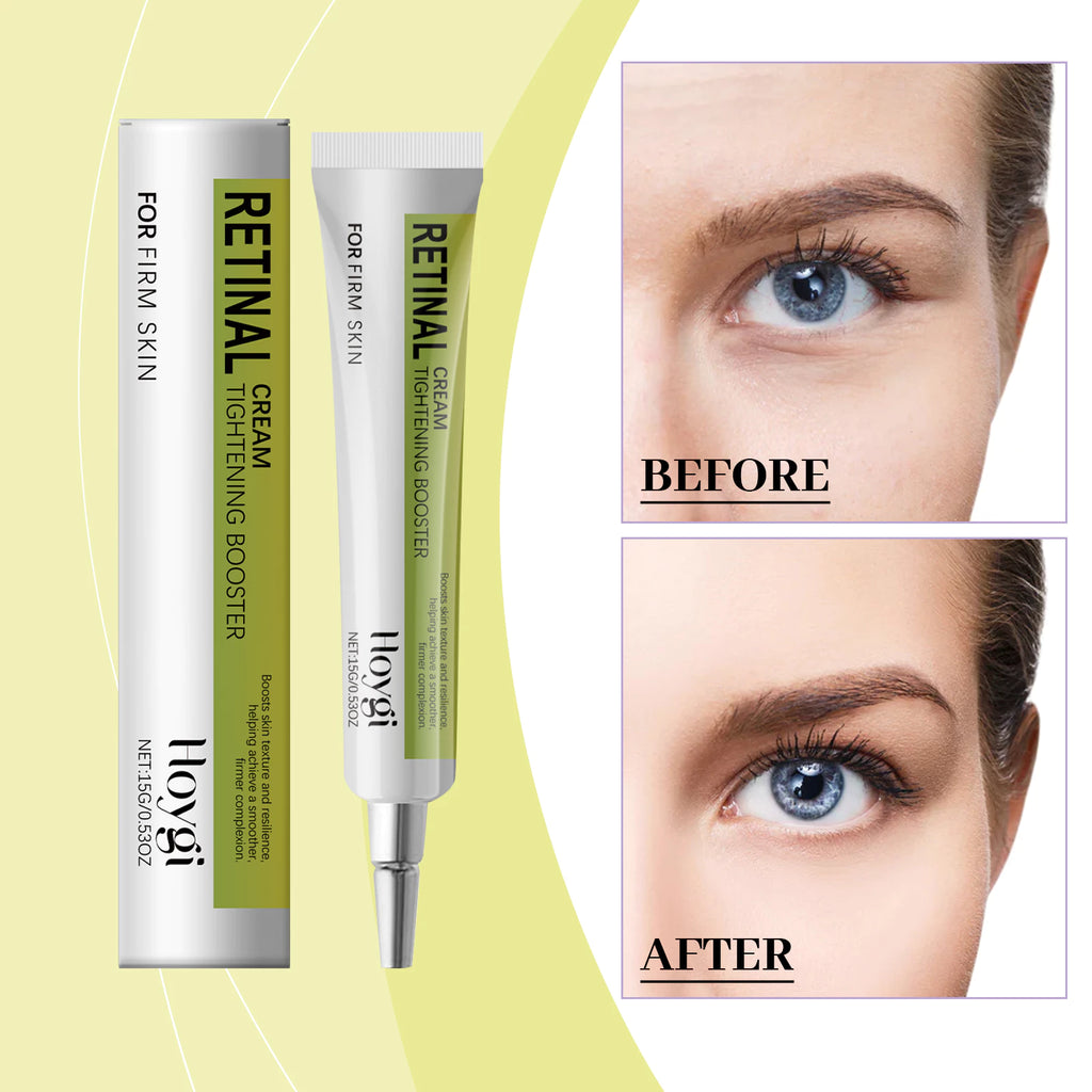 Hoygi Retinal Eye Cream – Gentle Nourishing Firming Moisturizing Eye Care