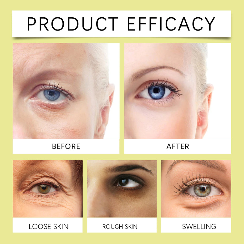 Hoygi Retinal Eye Cream – Gentle Nourishing Firming Moisturizing Eye Care