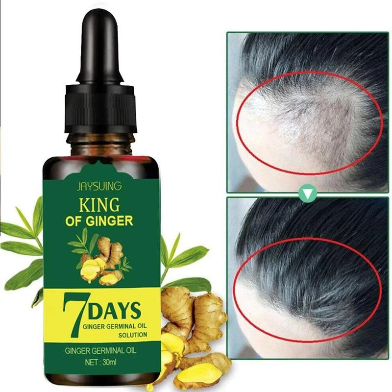 Jaysuing Hair Growth Oil - Ginger Essence King 7 Days Hair Loss & Growth Serum