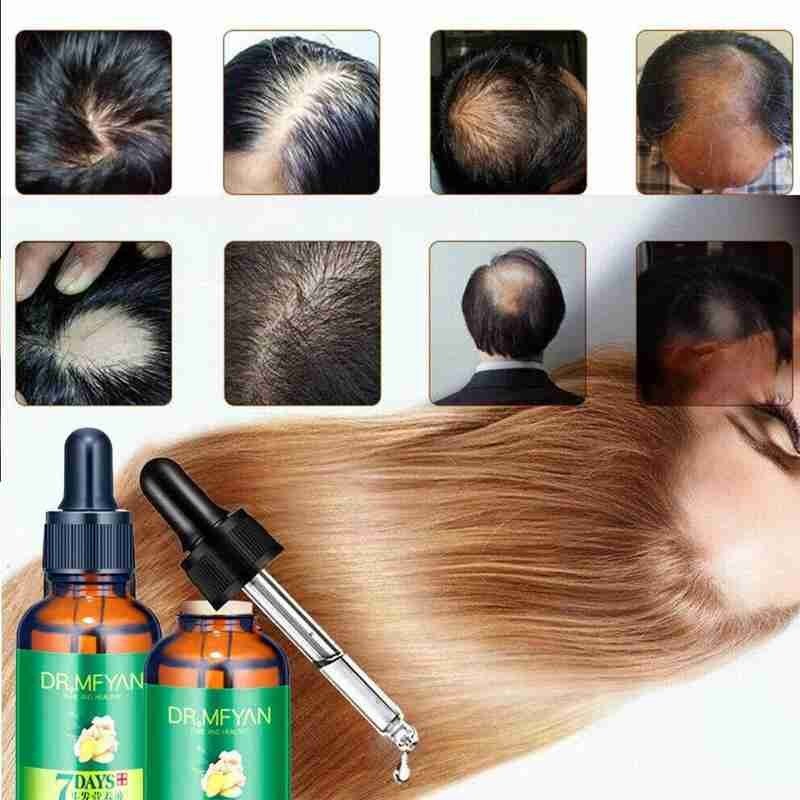 Jaysuing Hair Growth Oil - Ginger Essence King 7 Days Hair Loss & Growth Serum