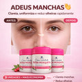 Kit 3 Rosehip Creams with Niacinamide – Whitening, Moisturizing and Skin Regenerating