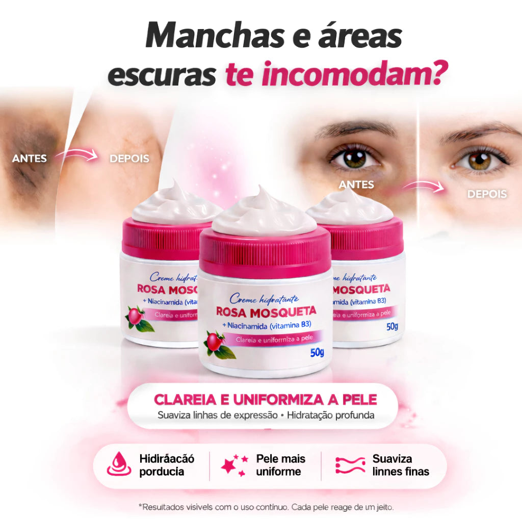 Kit 3 Rosehip Creams with Niacinamide – Whitening, Moisturizing and Skin Regenerating