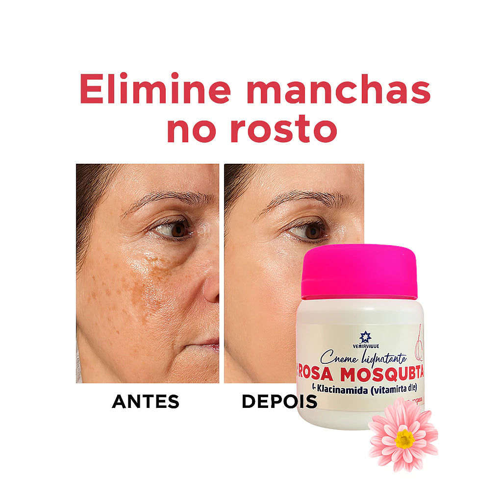 Kit 3 Rosehip Creams with Niacinamide – Whitening, Moisturizing and Skin Regenerating