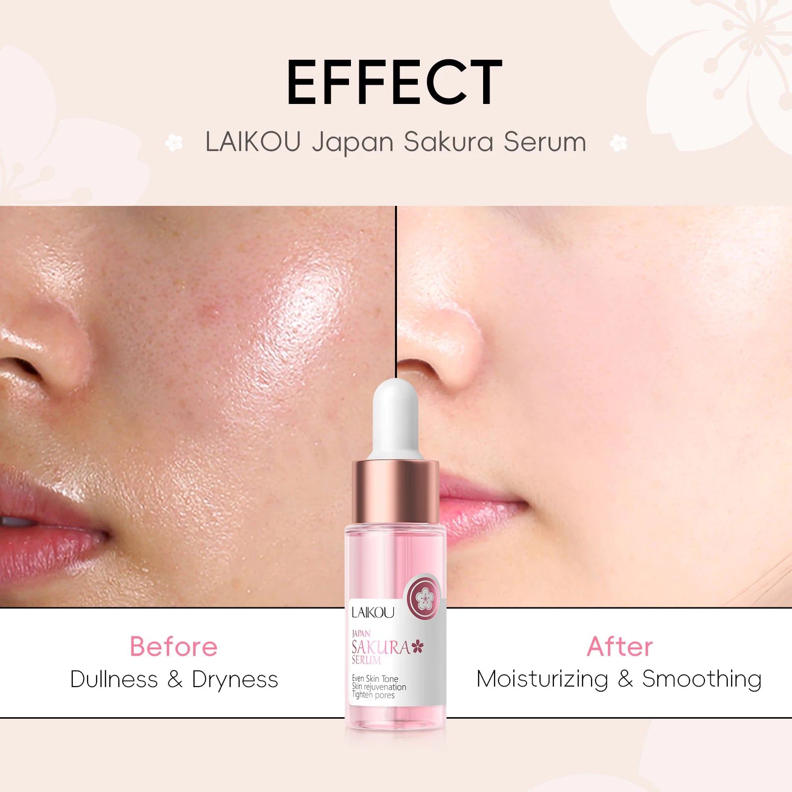 LAIKOU Japan Sakura Cherry Blossom Facial Serum – Blemish Removal & Skin Rejuvenation 17ml