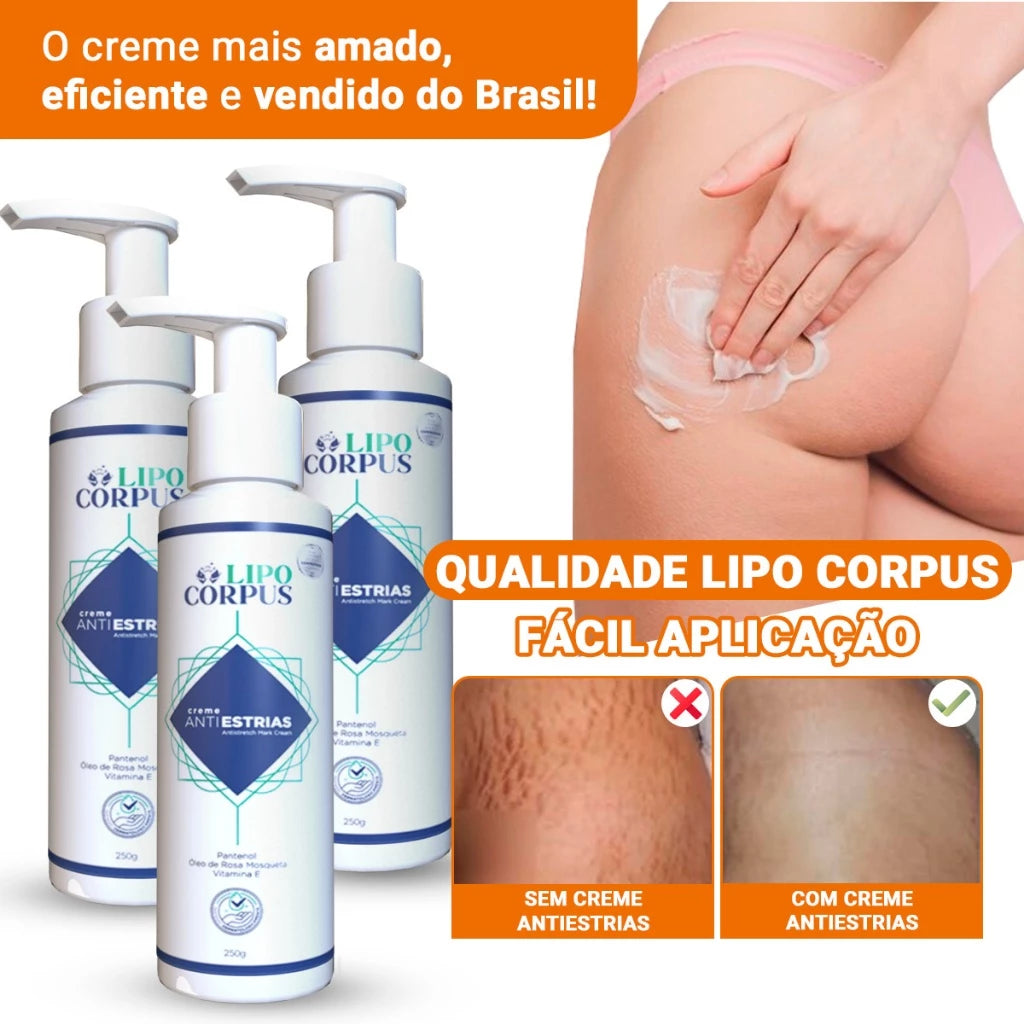 Lipo Corpus Anti-Stretch Mark Cream 250g – Powerful Action