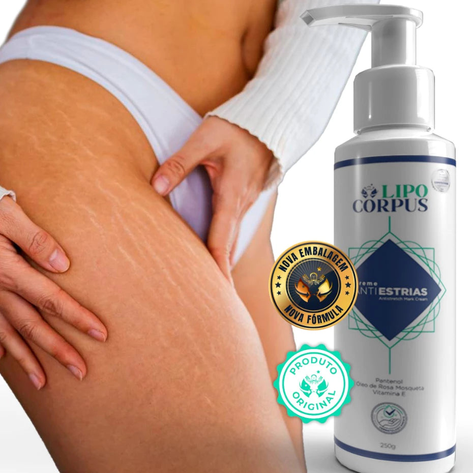Lipo Corpus Anti-Stretch Mark Cream 250g – Powerful Action