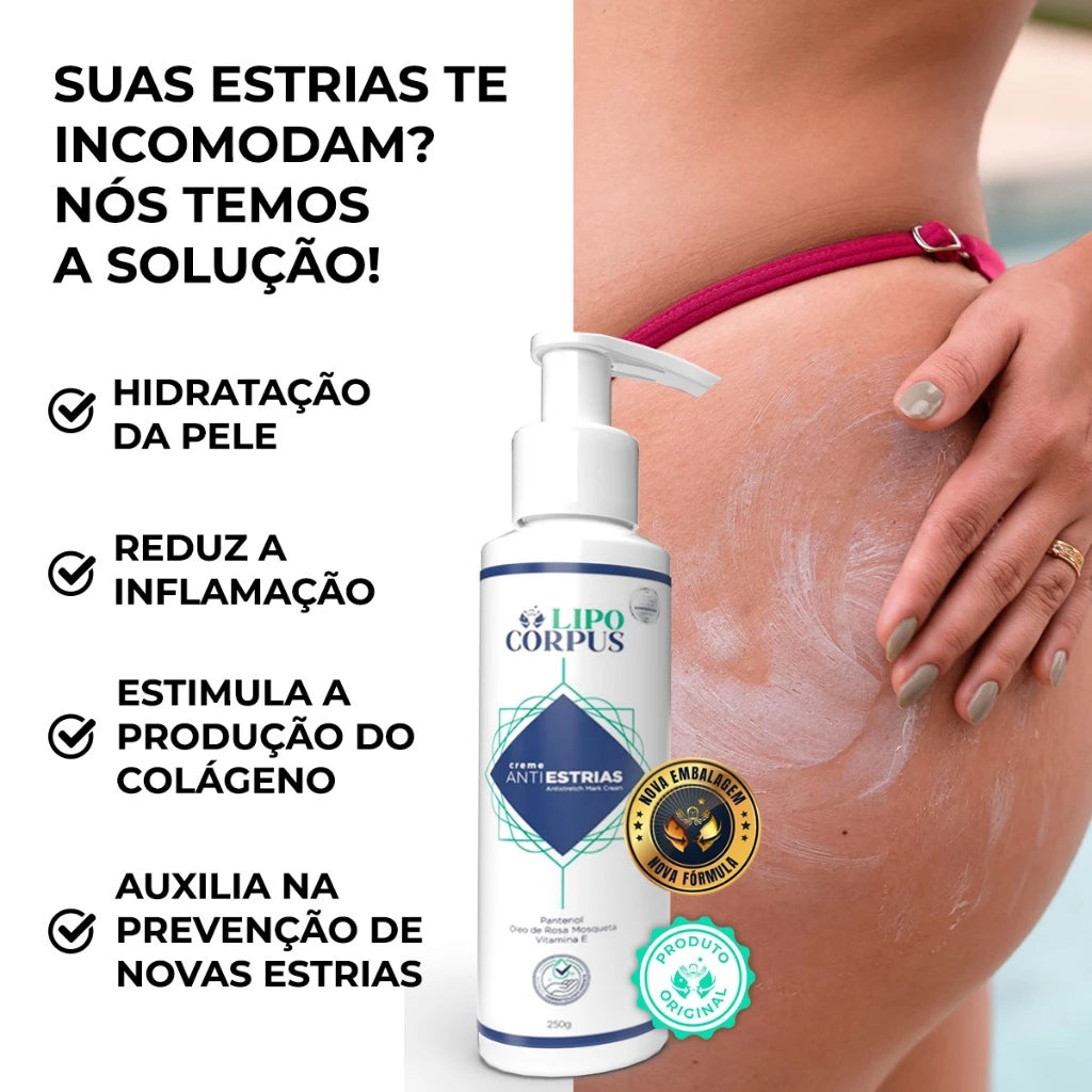 Lipo Corpus Anti-Stretch Mark Cream 250g – Powerful Action