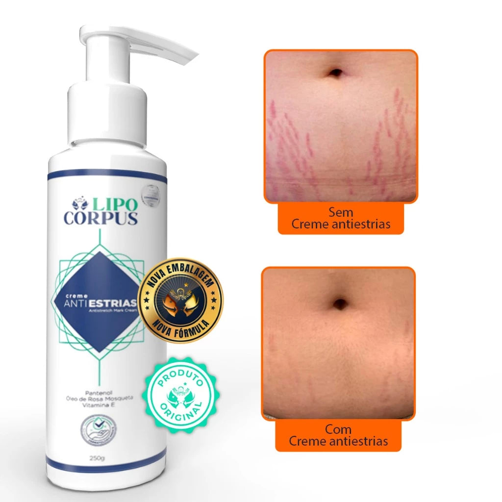 Lipo Corpus Anti-Stretch Mark Cream 250g – Powerful Action