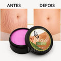 L&Beauty Moisturizing Body Cream for Stretch Marks 150g