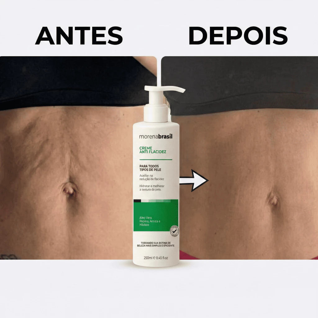 Morena Brasil Anti-Sagging Cream Say Goodbye to Sagging in Belly, Thighs and Arms