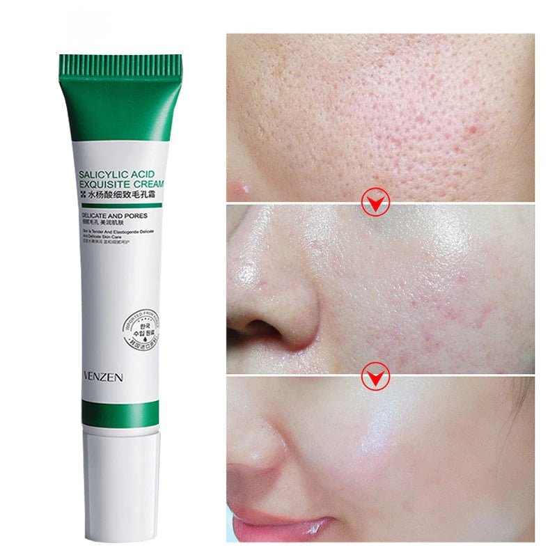 Creme Redutor de Poros com Ácido Salicílico 20g - Controle de Oleosidade e Antiacne