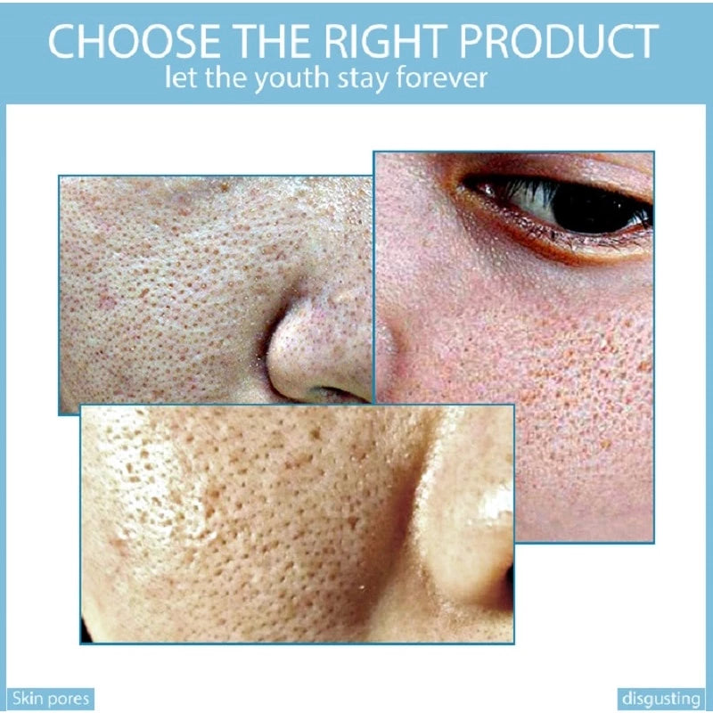 Creme Redutor de Poros com Ácido Salicílico 20g - Controle de Oleosidade e Antiacne