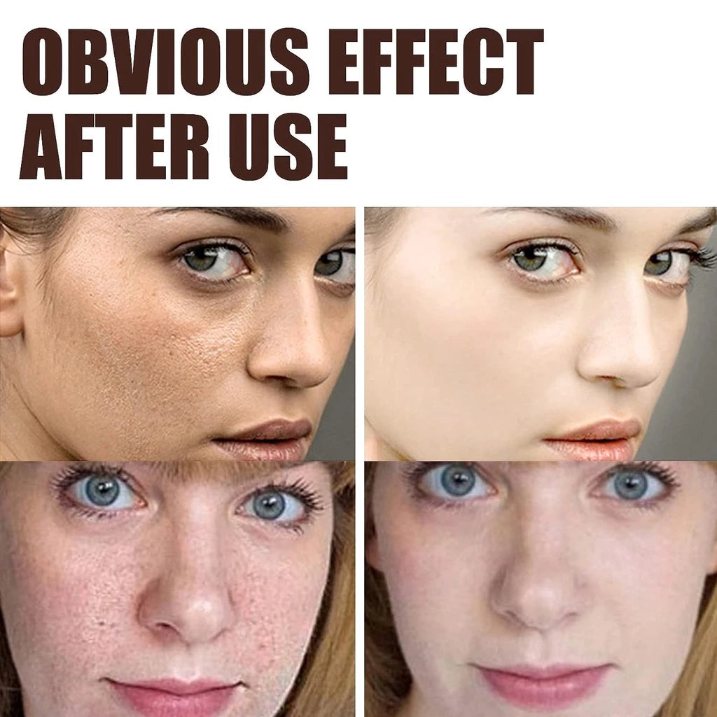 Retinol Anti-Aging Moisturizing Cream – Triple Action Firming, Lifting and Brightening Facial Care