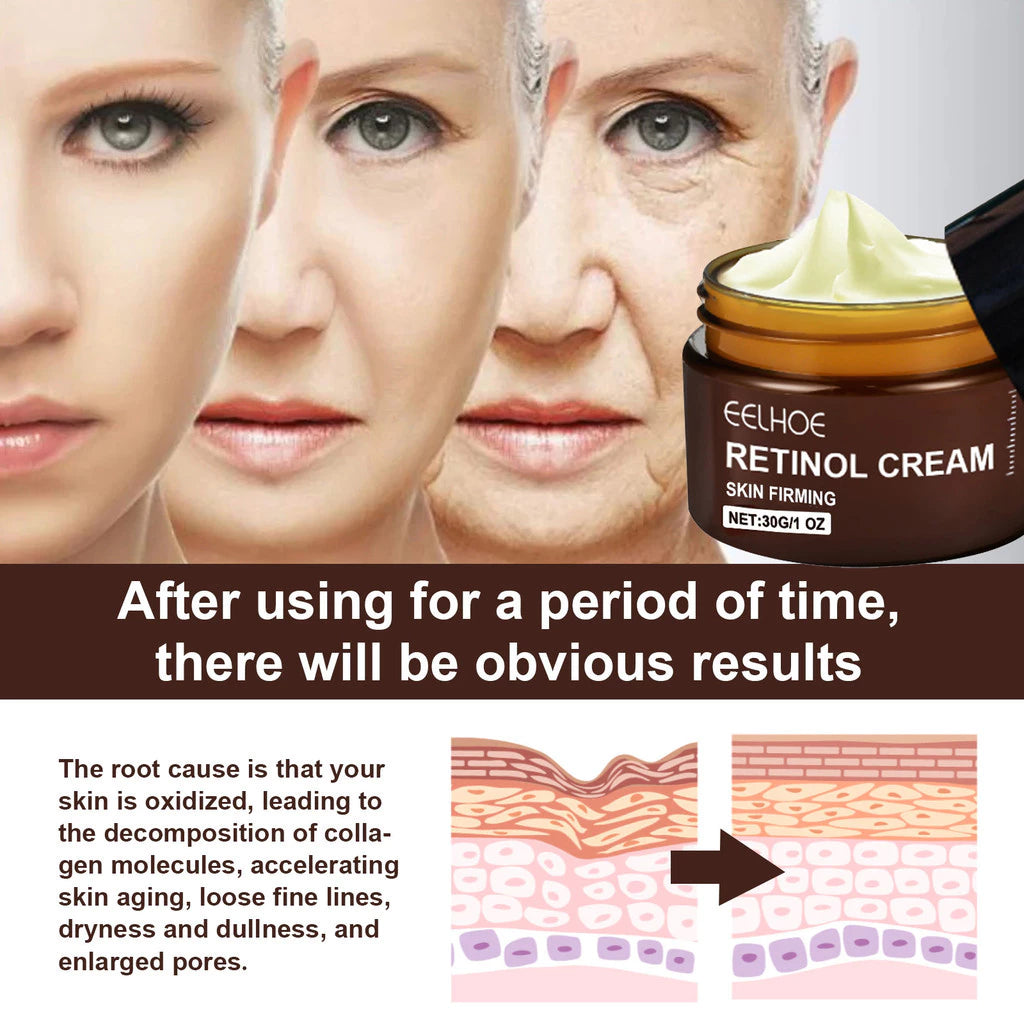 Retinol Anti-Aging Moisturizing Cream – Triple Action Firming, Lifting and Brightening Facial Care