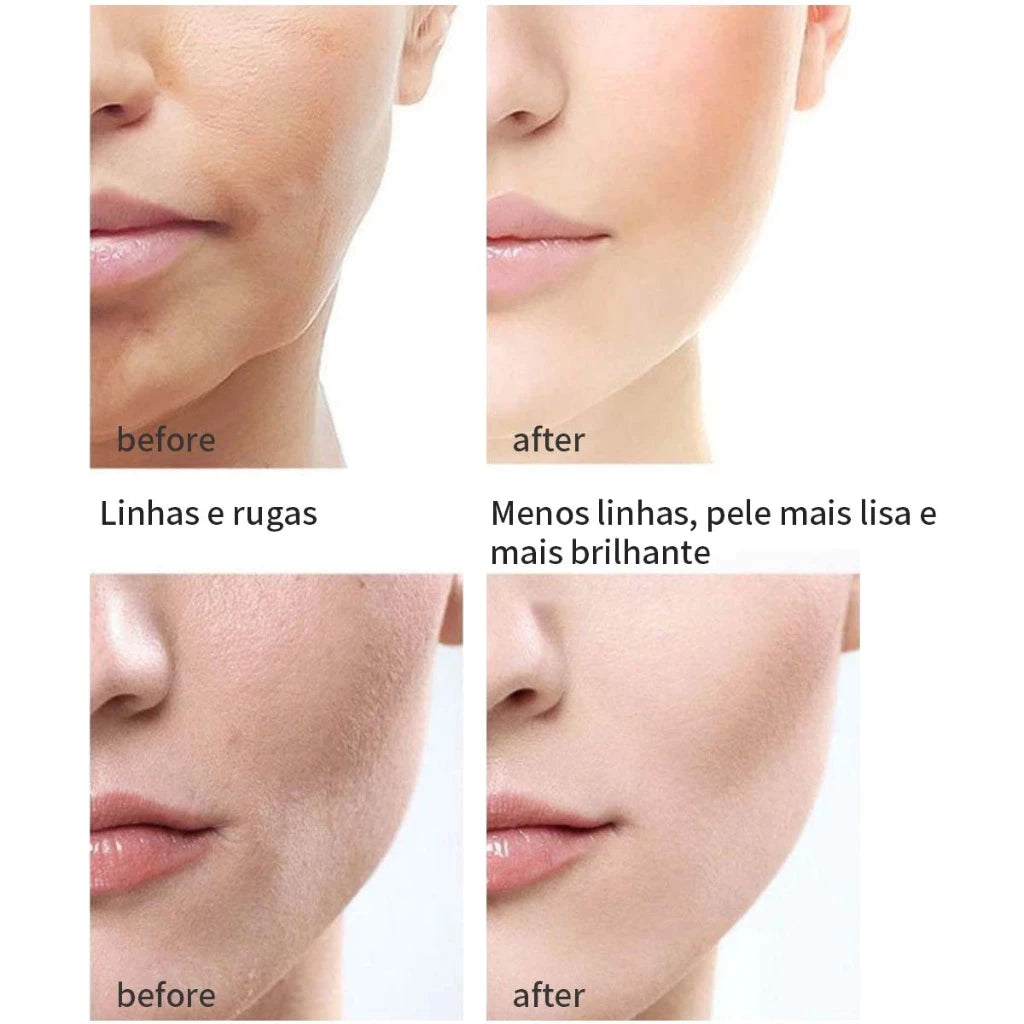 Creme Anti-Rugas Tecnologia Japonesa 28 Dias - Retinol, Firmador e Rejuvenescedor Facial