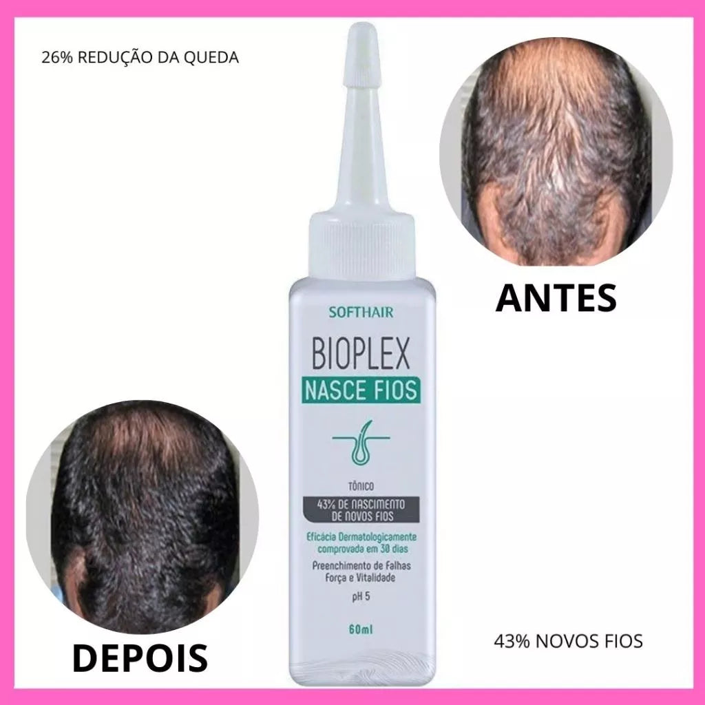 Tônico Bioplex Nasce Fios Soft Hair 60ml